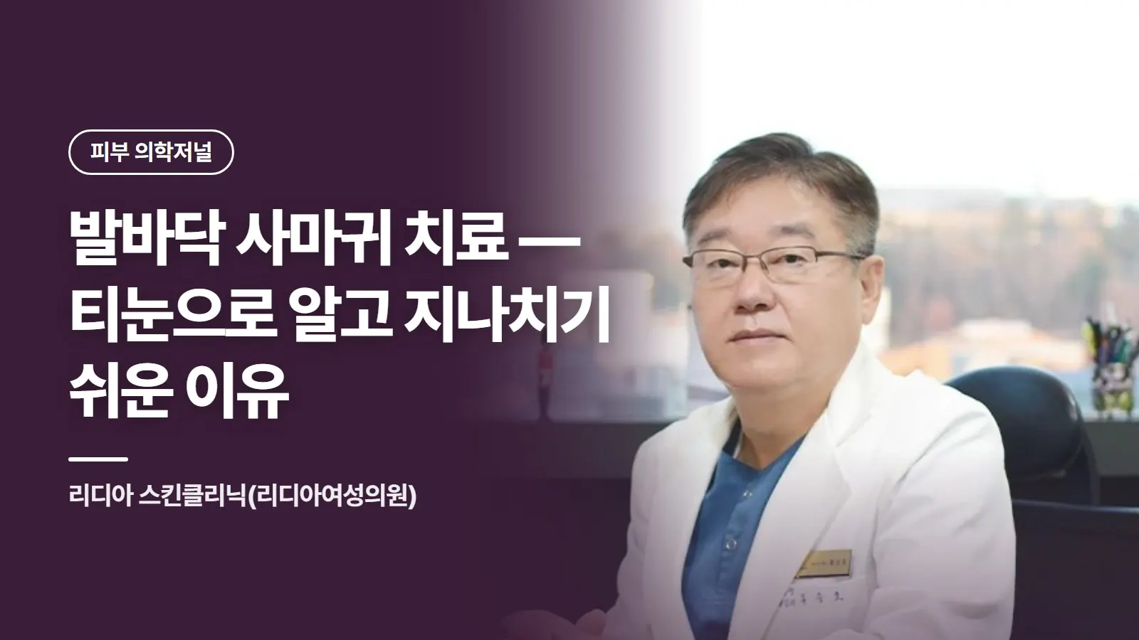발바닥 사마귀 치료 — 티눈으로 알고 지나치기 쉬운 이유