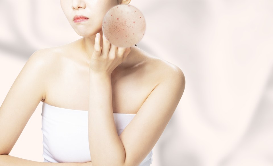 여드름 · 스킨부스터 시술 안내